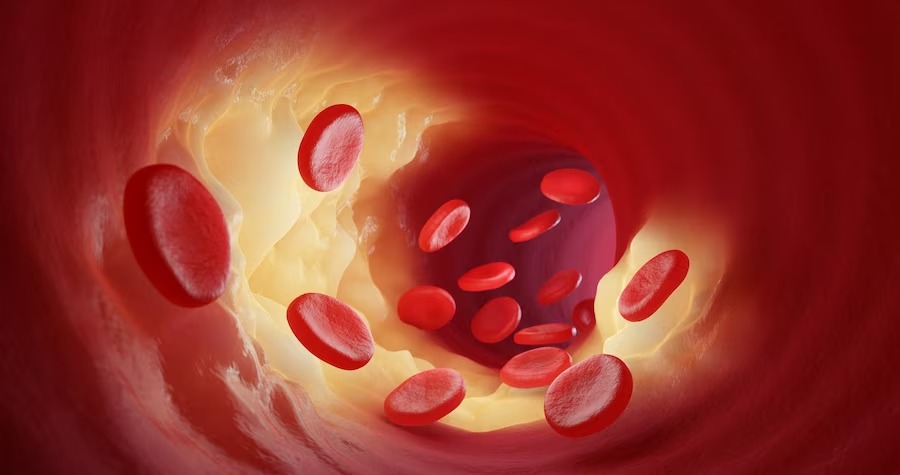 Read more about the article How Hyperbaric Oxygen Therapy Improves Blood Circulation